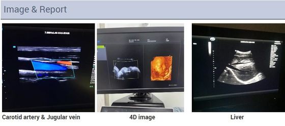 2D 3D 4D تخطيط صدى القلب عربة القلب صدى لون دوبلر آلة الموجات فوق الصوتية