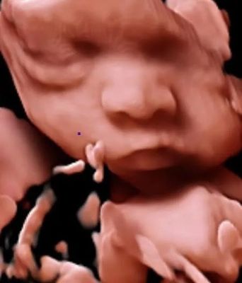 3D 4D 5D لون دوبلر بالموجات فوق الصوتية الماسح الضوئي عربة بالموجات فوق الصوتية لل OB GYN